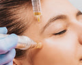Microneedling Therapy
